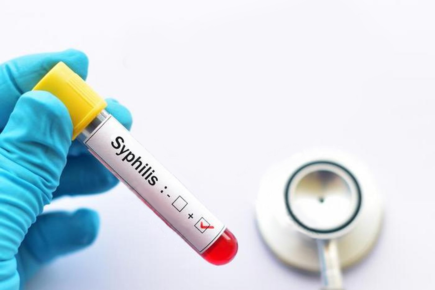 包图网89557454梅毒积极的-小样.jpg 包图网89557454梅毒积极的-小样.jpg